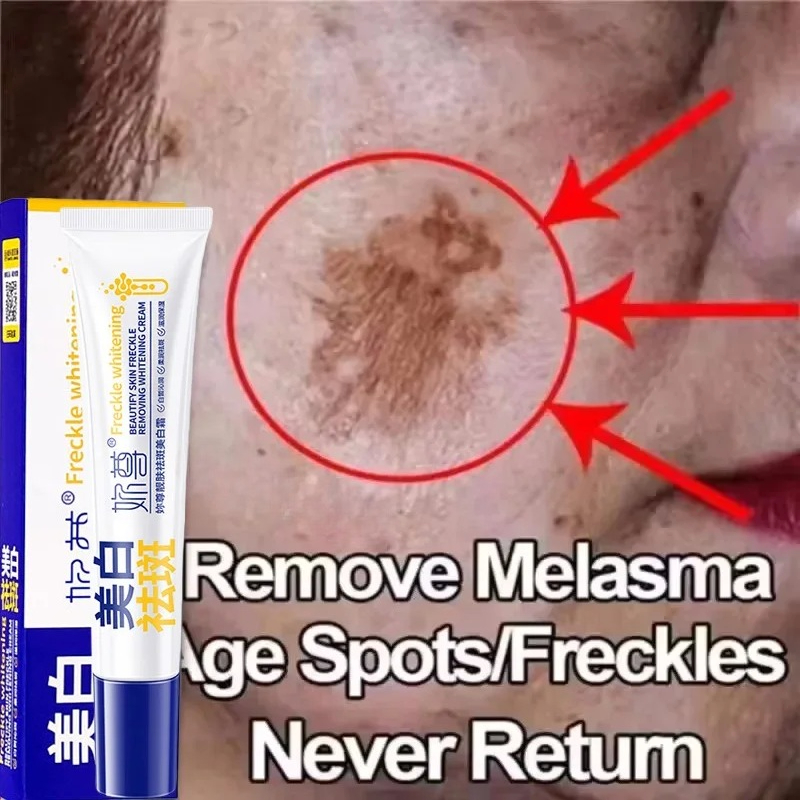 Night Cream - Powerful Spot-Removing Whiten Cream Brighten Skin