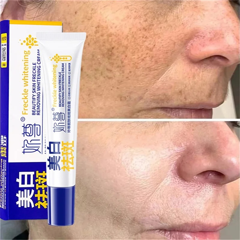 Powerful Spot-Removing Whiten  - Night Cream review and price