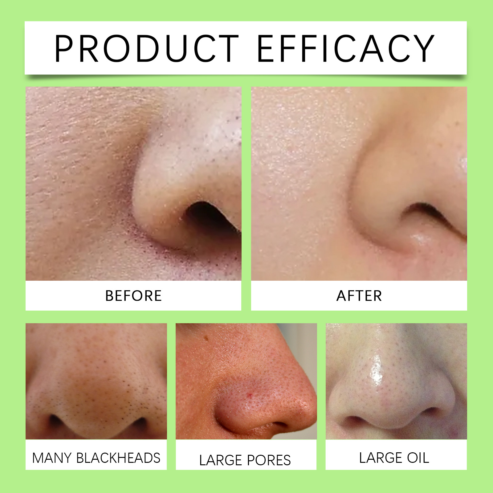 Bamboo Charcoal Nose Strips fo - Skincare China review and price