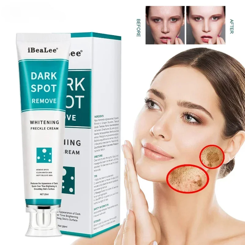 Whitening Freckle Cream Remove - Retinol Cream review and price