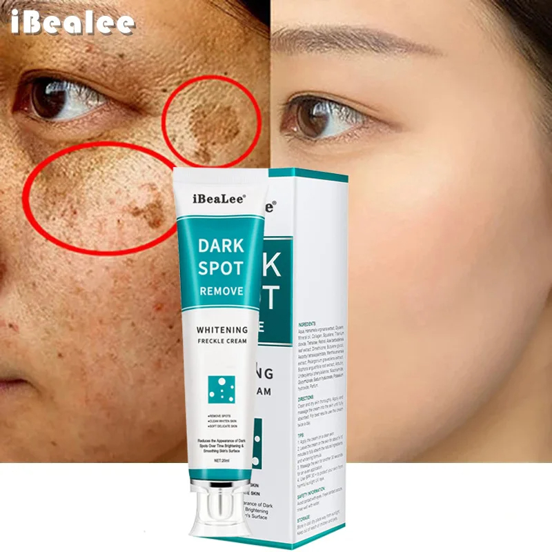 Whitening Freckle Cream Remove - Retinol Cream review and price