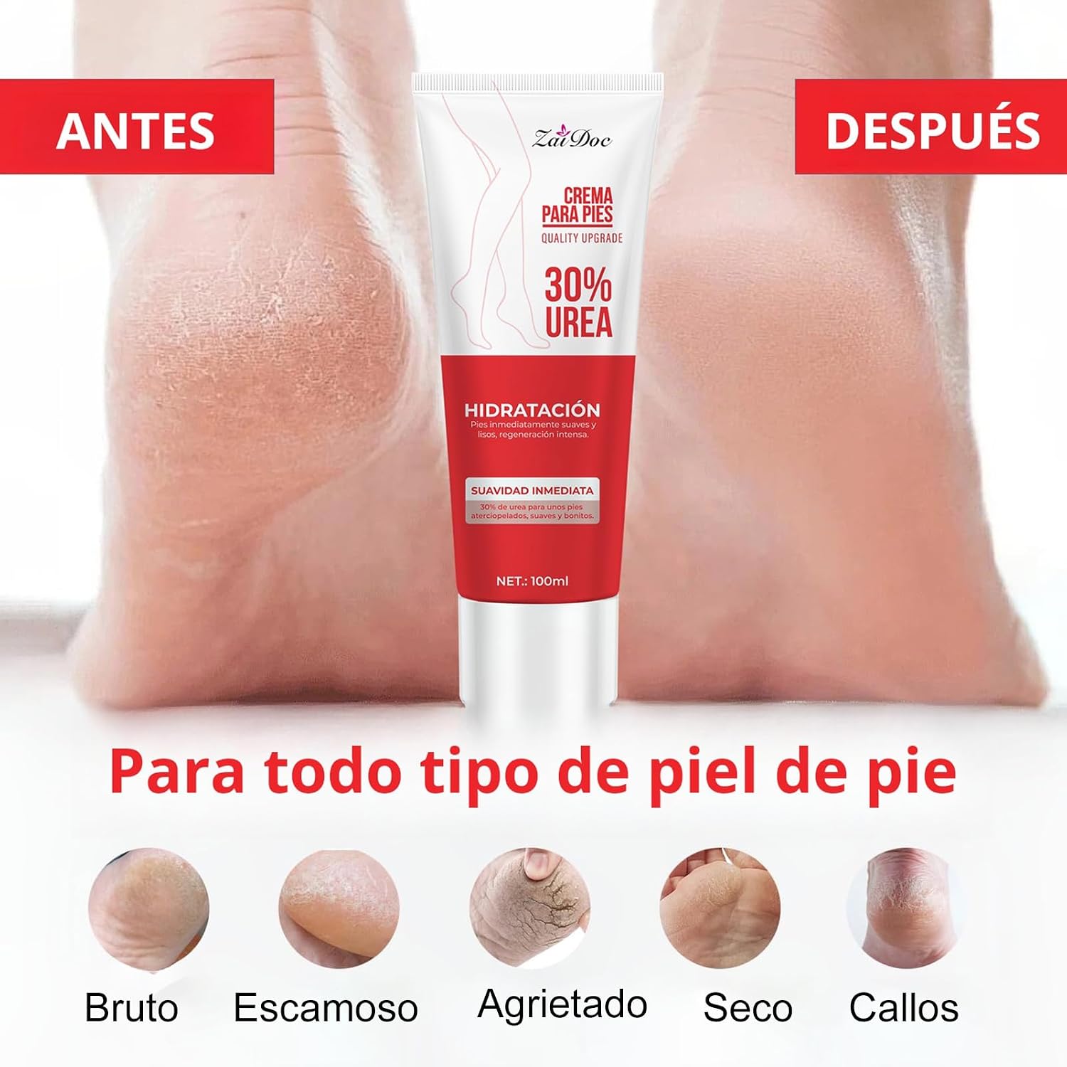 ZaiDoc 2/4 Pcs Urea Foot Cream - Urea Foot Cream review and price